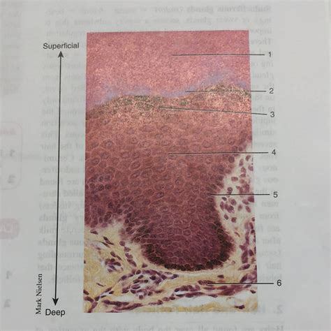 Label The Photomicrograph Of Thick Skin Integumentary System Diagram