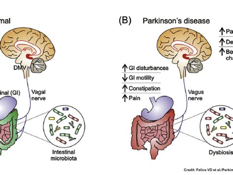 Parkinsons Disease Archives Gut Microbiota For Health