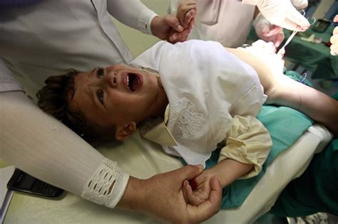 Fewer Circumcisions Could Cost The Us Billions Study
