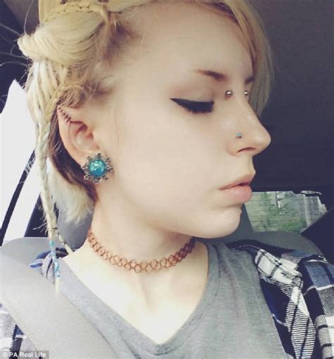 Body Modification Fanatic Has Her Ears Reshaped To Look Like An Elf