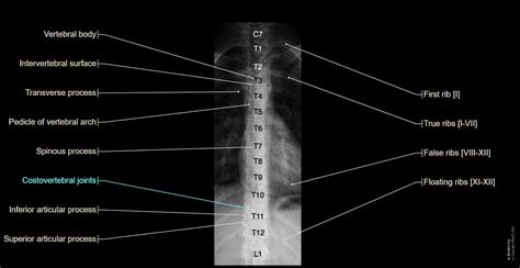 Anatomy of the spine: normal anatomy | e-Anatomy