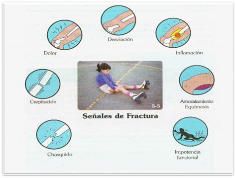Primeros Auxilios Y Prevenci N De Desastres Lesiones En Huesos Articulaciones Y M Sculos
