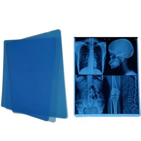 Polyester 210 Micron X Ray Film At Rs 3000piece In Madurai Id