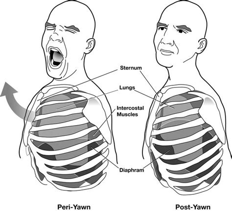 Jennifer tarle from tarle speech and language g. Is yawning a tool for wakefulness or for sleep?