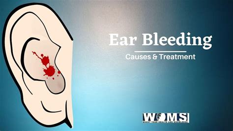 Vital Facts About Ear Bleeding In 2021 Woms