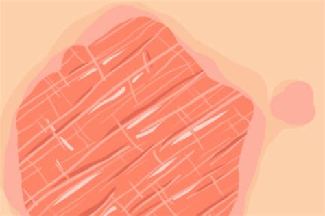 Here Are The 7 Most Common Types Of Eczema And How To Treat Each One