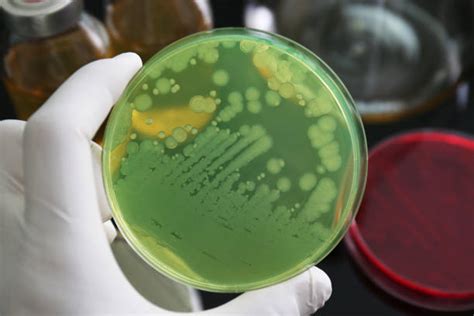 Pseudomonas Aeruginosa Stock Photos Pictures And Royalty Free Images