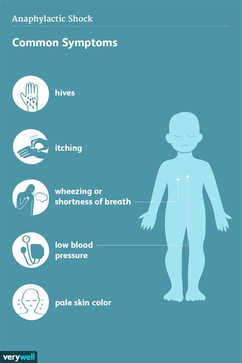 Webmd explains how to recognize an anaphylactic reaction and how to get help. Anaphylaxis: Signs, Symptoms, and Complications