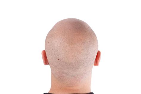 Royalty Free Bald Head Back Pictures Images And Stock Photos Istock