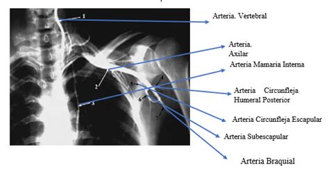 Blog De Anatomía Radiológica Humana Unad Grupo 15400311 Tema 1