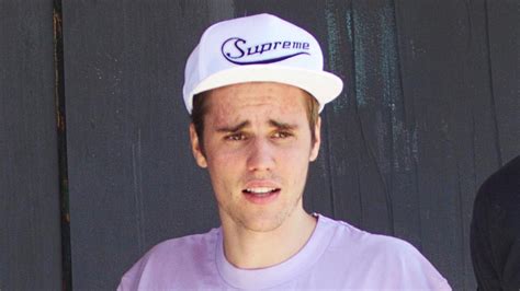 Justin Bieber Reveals Hes Battling Lyme Disease In Documentary