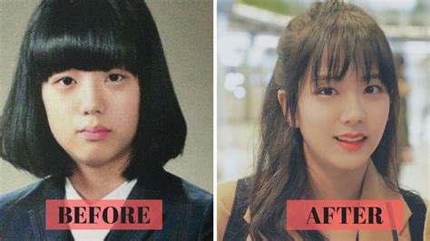 Blackpink Before And After Plastic Surgery Blackpink Reborn 1593 Hot Sex Picture
