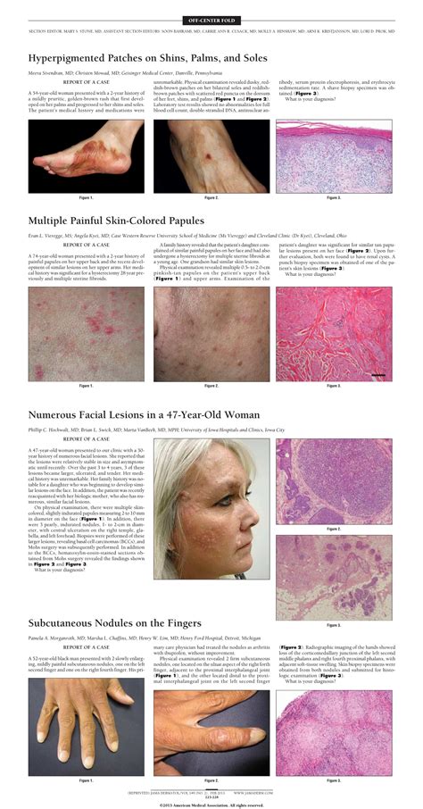numerous facial lesions in a 47 year old woman—quiz case dermatology jama dermatology the