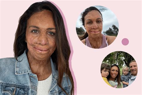 A Day In The Life Of Turia Pitt From Am Wake Ups