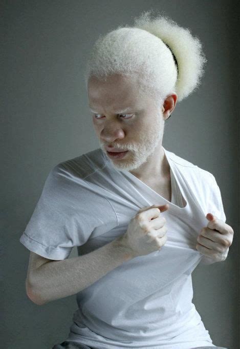 Tausendsassa Albino Men Albinism Interesting Faces