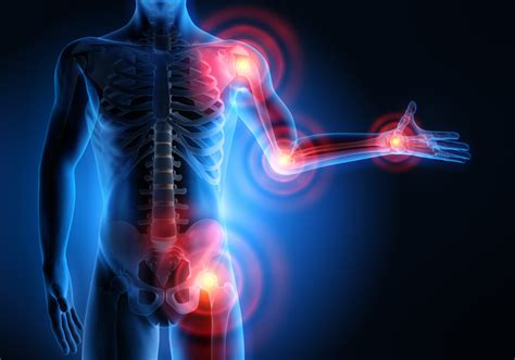 Joint Pain Causes Symptoms And Management Vad