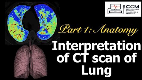 Interpretation Of Ct Scan Of Lung Part 1 Youtube