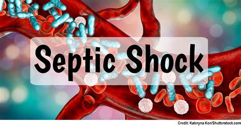 Septic Shock Nclex Questions