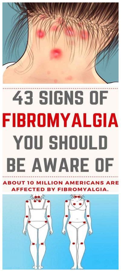 fibromyalgia and hair loss