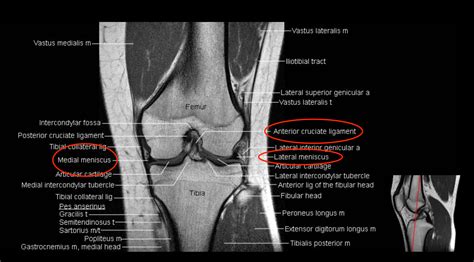 Knee Muscle Anatomy Mri Sagittal Mri Scan Of The Knee Showing The