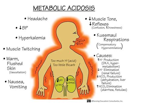 Metabolic Acidosis Nursing Mnemonics Metabolic Acidosis Nursing School Survival