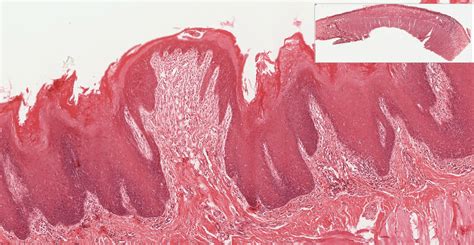 Oral Cavity Histology