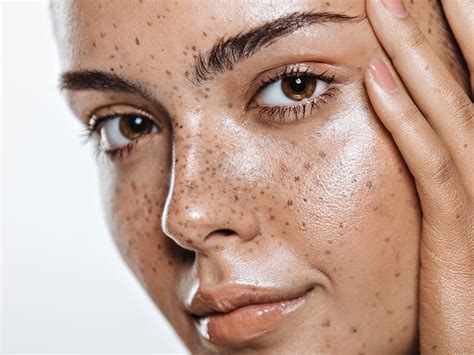 How To Keep Your Freckles Safe According To 4 Experts Newbeauty