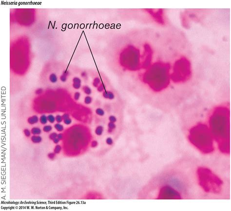 Detail Of Structure Of Neisseria Gonorrhoeae Medical Laboratory Microbiology Medical