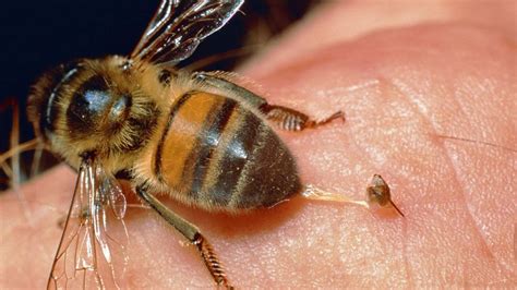 ‘how A Bee Sting Saved My Life’ Bbc Future