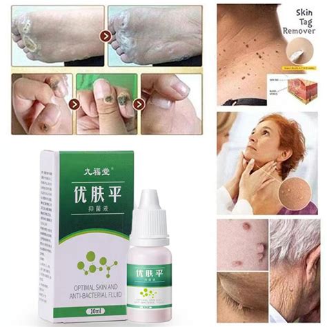 Boxes Removal Serum Warts And Skin Tags Remover Warts Remover