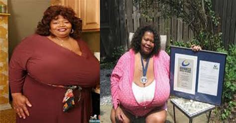 Annie Hawkins The Woman With The Biggest Natural Breasts In The World Afroculture Net