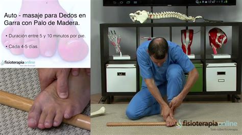 Tratamiento Para Los Dedos En Garra Fisioterapia Bilbao Youtube