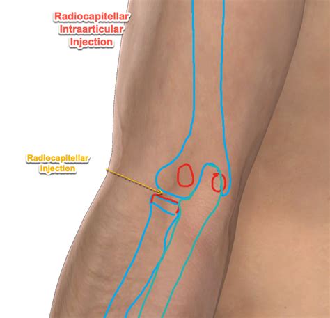 Elbow Anatomy | Sport Med School