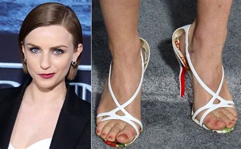 28 Celebs With Ugly Feet Gross Corns And Crusty Hammer Toes