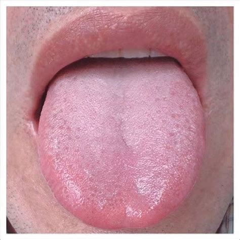 通过你的舌头，了解你的健康 北京中医疑难病研究会