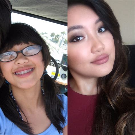 Braces Glasses And Super Weird Bangs 1323 Uglyduckling