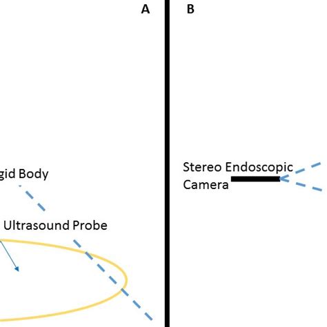 Clinical Scenarios Of A Ultrasound Guided Needle Biopsy And B