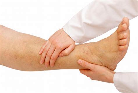 What Are The Symptoms Of Ankle Gout With Pictures