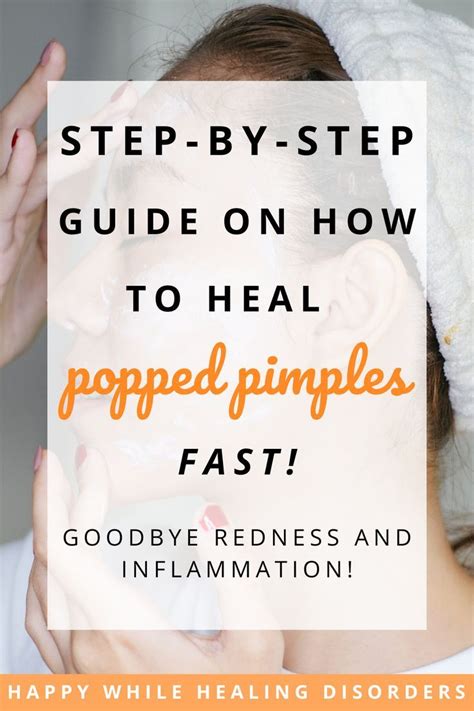 How To Heal Popped Pimple Fast At Home Pimples Redness Pimple