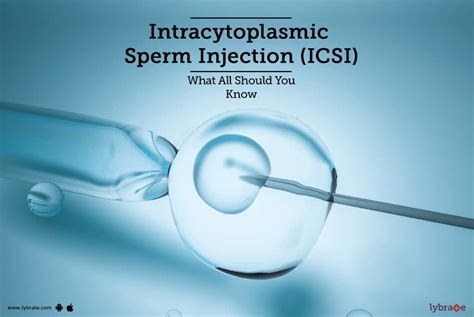 Intracytoplasmic Sperm Injection Icsi What All Should You Know By