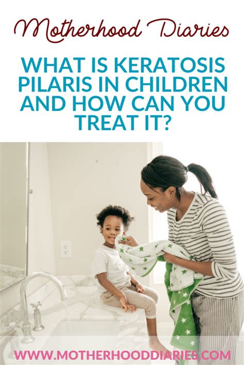 What Is Keratosis Pilaris In Children And How Can You Treat It