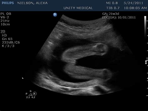 Dear Baby 20 Week Ultrasound