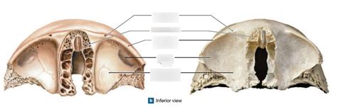 Frontal Bone Inferior View Diagram Quizlet