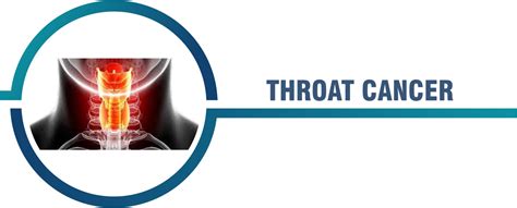 Throat Cancer Global Care