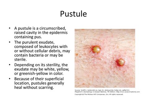 Ppt Dermatological History And Examination Powerpoint Presentation