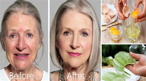 🔥 Unbelievable 1 Smart Trick To Rapidly Remove Wrinkles And Fine Lines