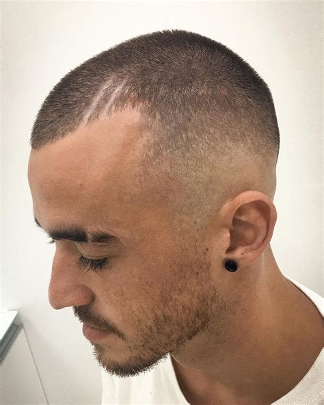 Benzema und die halbe frisur. Karim Benzema Haircut