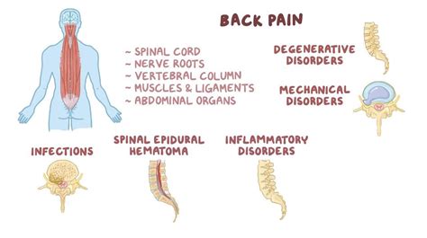 Medical Massage For Low Back Hip And Sciatica Relief 8ces Living Metta