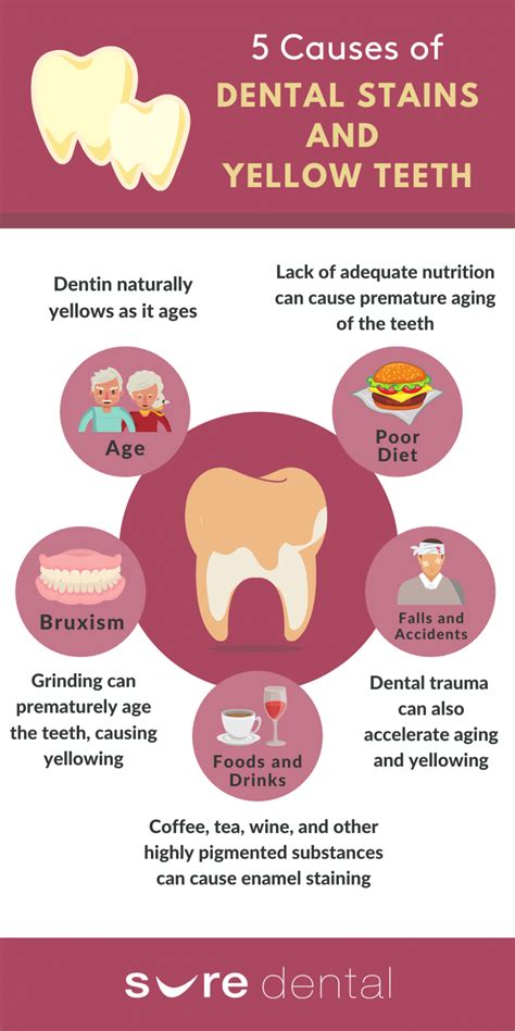 What Really Causes Dental Stains And Yellow Teeth Infographic Sure