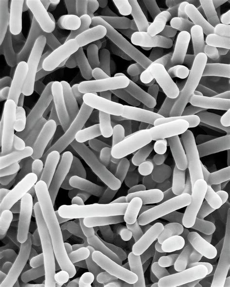 Bifidobacterium Sp Probiotic Photograph By Dennis Kunkel Microscopy